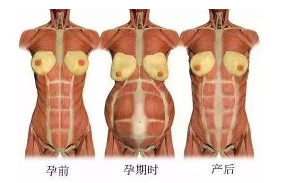 產(chǎn)后媽媽骨盆修復――帶你回到完美身材！