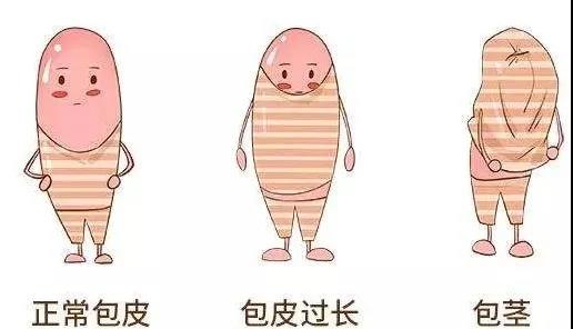 【保山安利醫(yī)院】家長速看！暑期包皮手術(shù)預(yù)約正當(dāng)時！