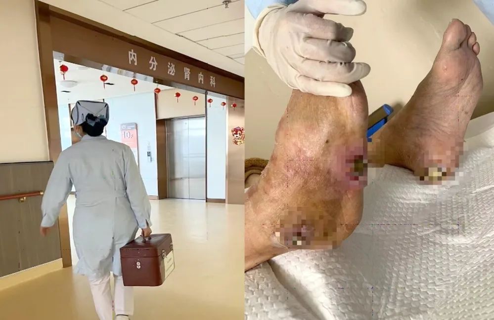 【保山安利醫(yī)院】傷口治療一站式，健康生活零距離！